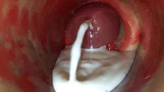 Camera Inside Deep Pussy Captures Boastfully Ejaculation of Sperm ASMR